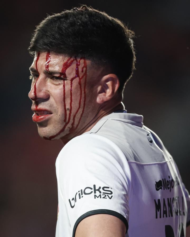 Imagen Matías Mansilla, herido tras el planchazo de Elián Irala.