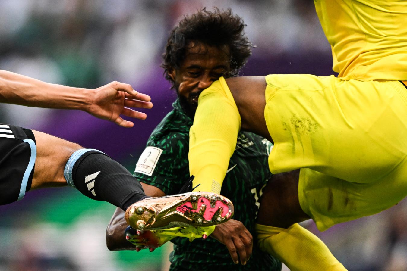 El futbolista de Arabia Saudita que debe ser operado de El Gráfico