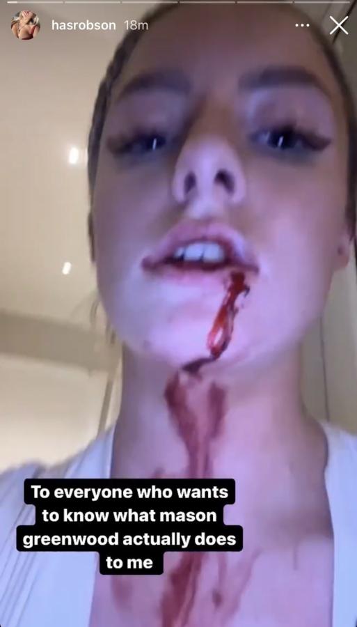 Imagen La contundente imagen que dio a conocer Harriet Robson