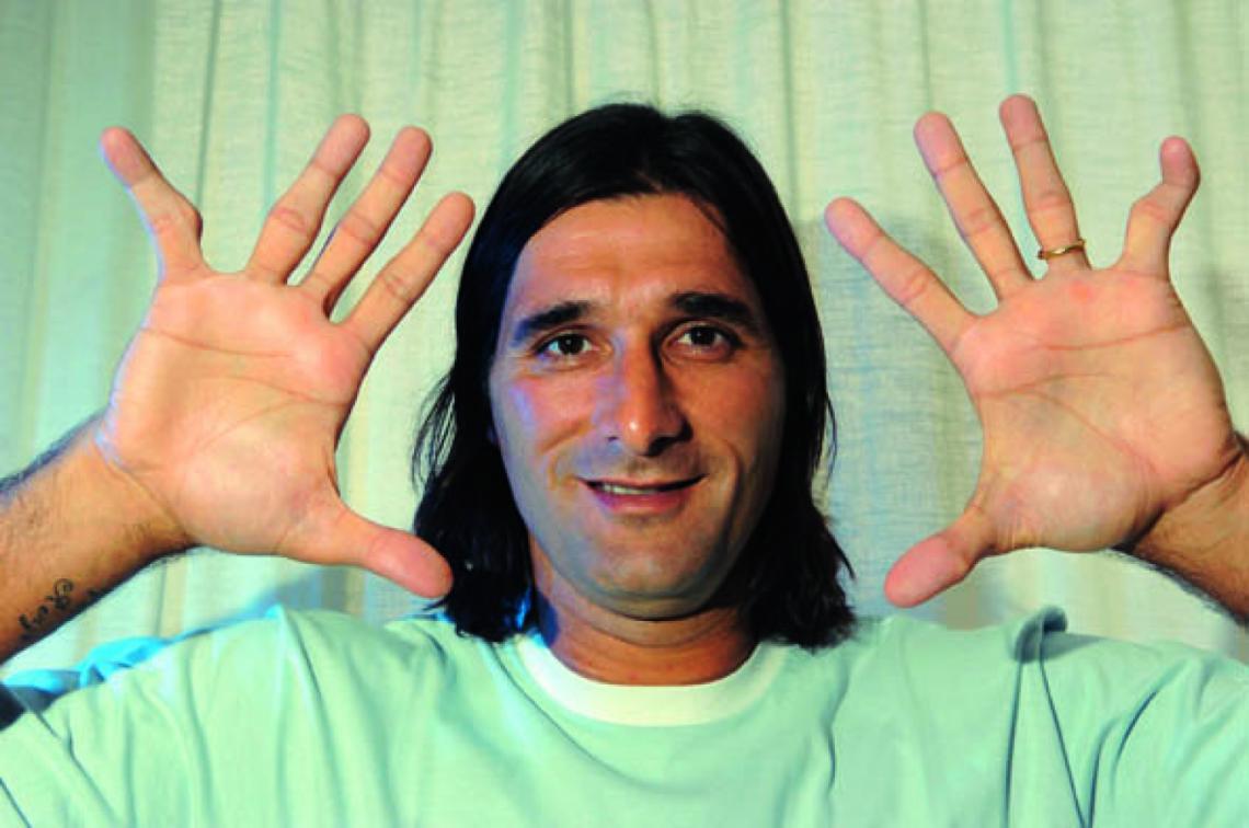 NO HAY PHOTOSHOP, son los dedos de Sessa. El meñique izquierdo se rompió y fue operado.