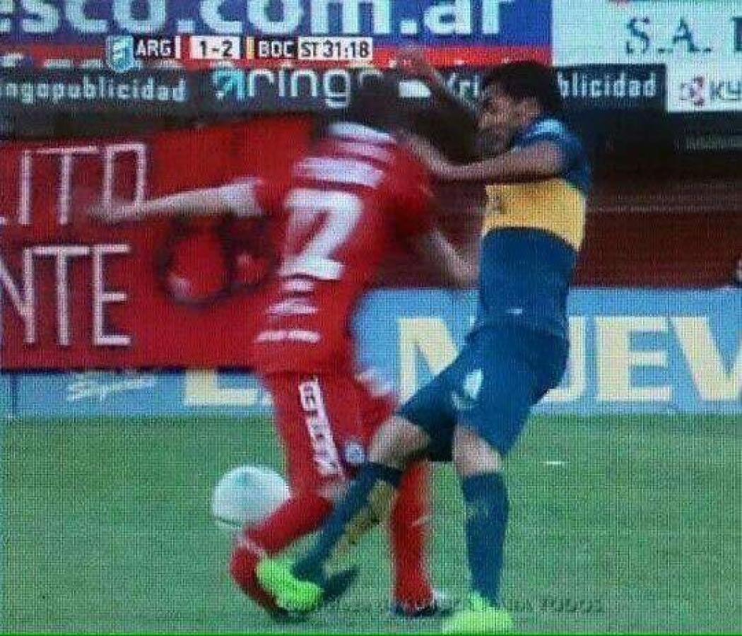 fractura
