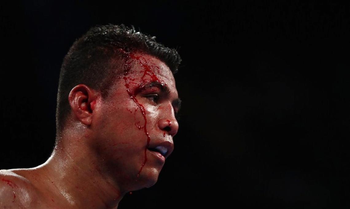 Imagen Chocolatito, con el rostro ensangrentado durante la pelea.