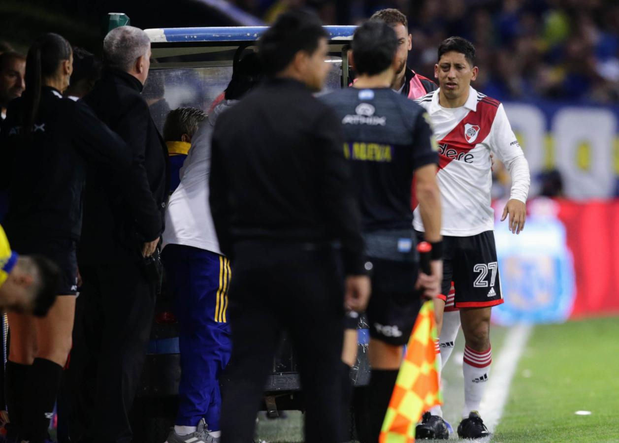 Imagen Rodrigo Aliendro, con la cara masacrada, tras sufrir un pisotón de Alan Varela. Foto: Fotobaires.