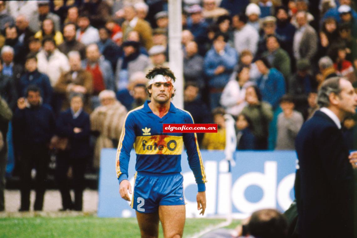 Después de un breve paso por Atlético Nacional de Colombia, Brown jugó en Boca Juniors en 1985. En la foto sangrando después de un choque con su compañero Hrabina.