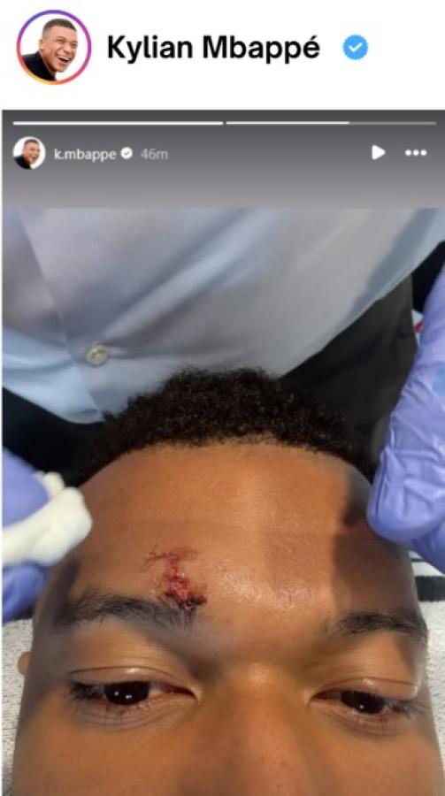 Imagen La foto que subió Mbappé a sus historias de IG