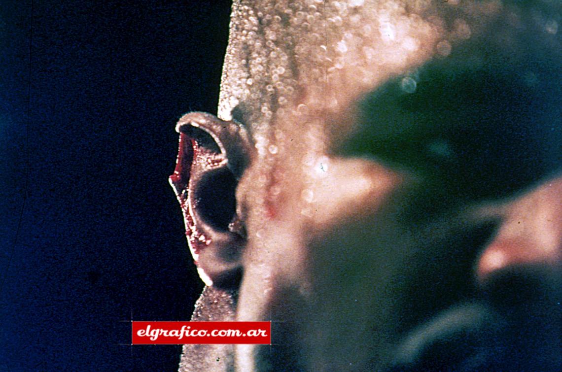 Así quedó la oreja de Holyfield. Mike Tyson fue descalificado.