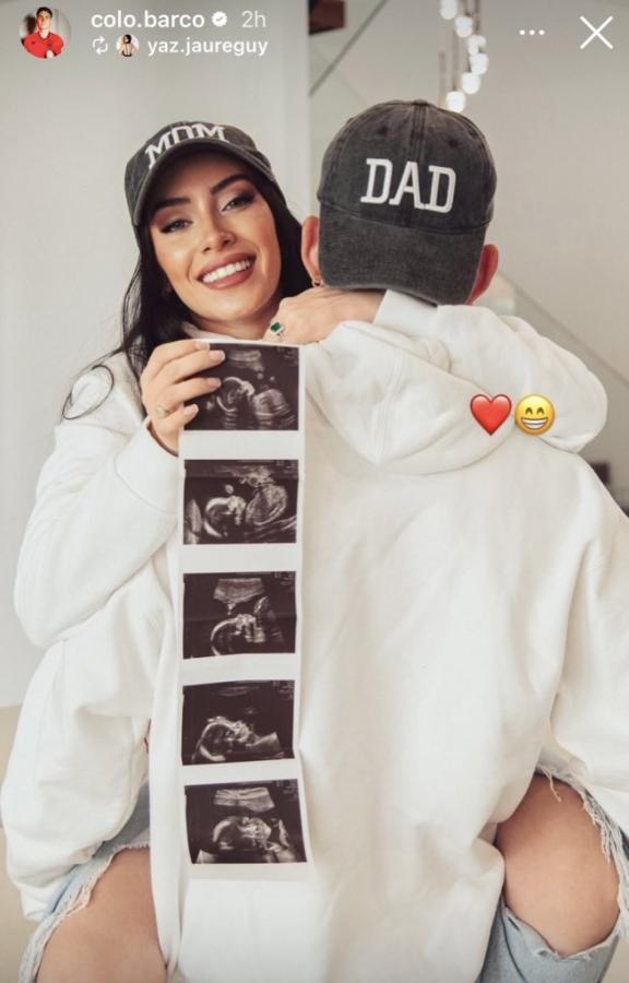 Imagen La imagen de la ecografía del hijo que espera Valentín Bargo junto con su compañera Yaz Jaureguy.