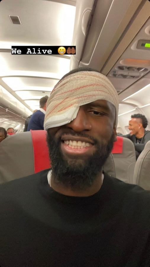 Imagen "Estamos vivos", posteó Antonio Rudiger luego de recibir 20 puntos de sutura por un golpe