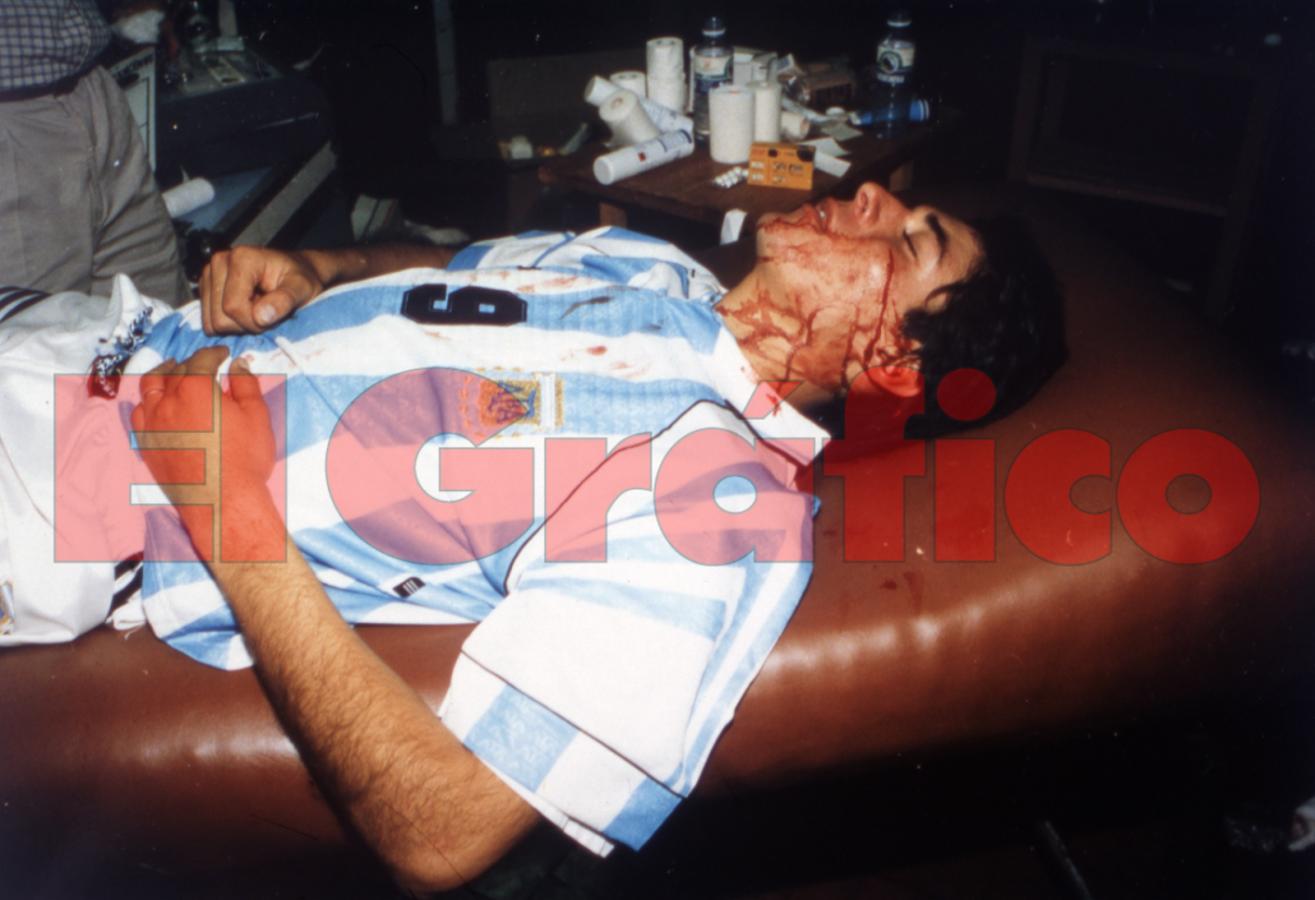 Julio Cruz en la camilla, ya con el corte en el pomulo contrario al del golpe. Bochorno. Fotógrafo Fabián Mauri