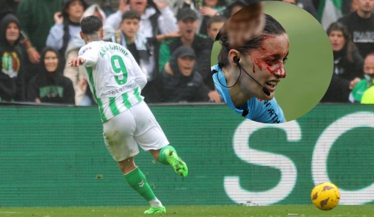 Imagen de Chimy Ávila y un accidentado estreno goleador con la camiseta de Betis