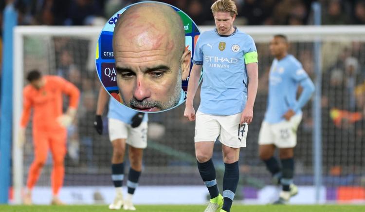 Imagen de Pep Guardiola apareció lleno de rasguños luego del papelón de Manchester City