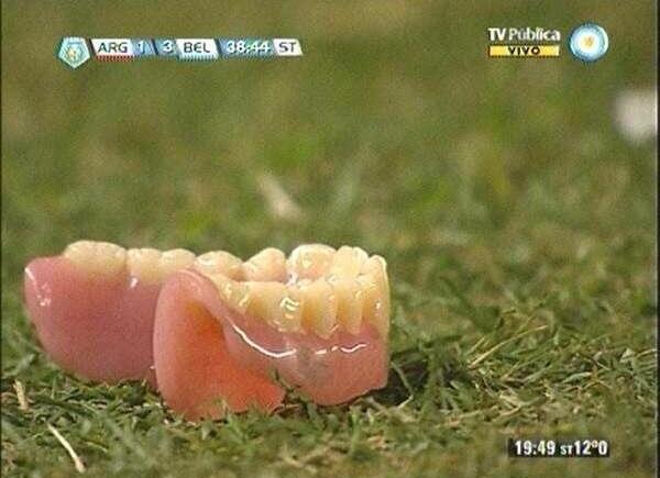 Imagen de Fue a la cancha y volvió a su casa sin los dientes