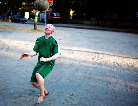 Imagen de "El botín" / Más que mil palabras [sobre los albinos en Tanzania]