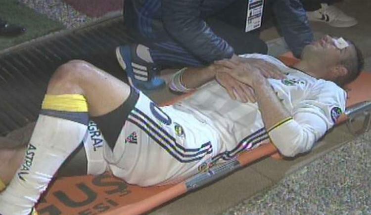 Imagen de Terrible lesión en el ojo del holandés Van Persie