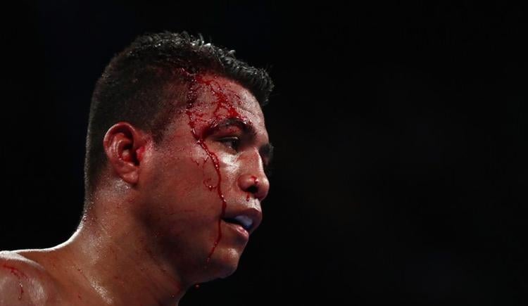 Imagen de Operaron a Chocolatito González
