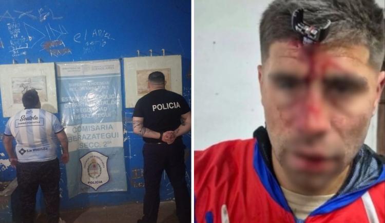 Imagen de Imágenes sensibles: Le clavaron una llave en la cabeza a un jugador de Lamadrid