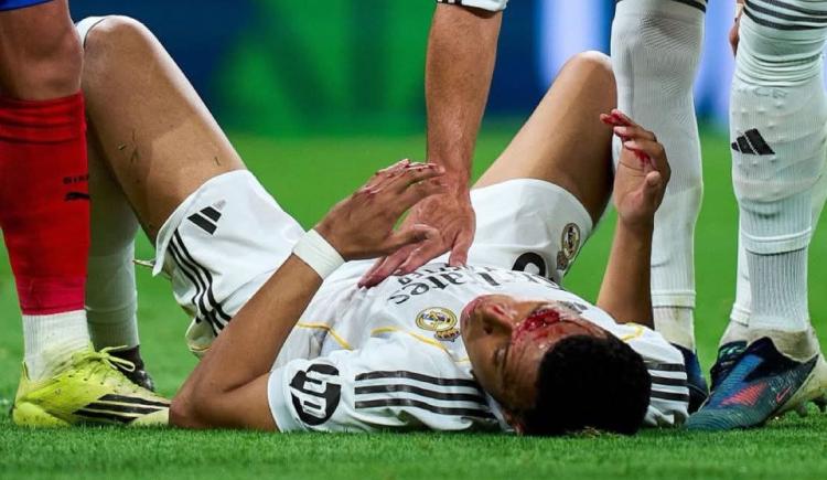 Imagen de El codazo a Mbappé que reclamó todo Real Madrid: "Es penalti aquí y en la luna"