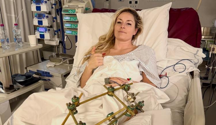 Imagen de La esquiadora legendaria reveló que casi le amputan la pierna que se lesionó gravemente