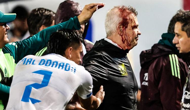 Imagen de La salvaje agresión al entrenador de México