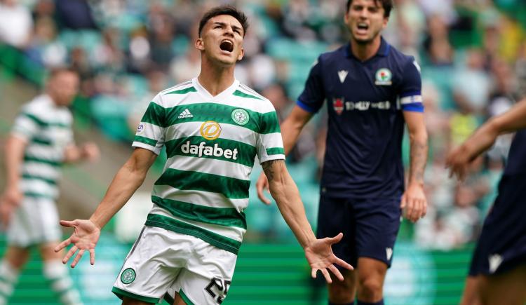 Imagen de Bernabei tuvo su debut como titular en Celtic