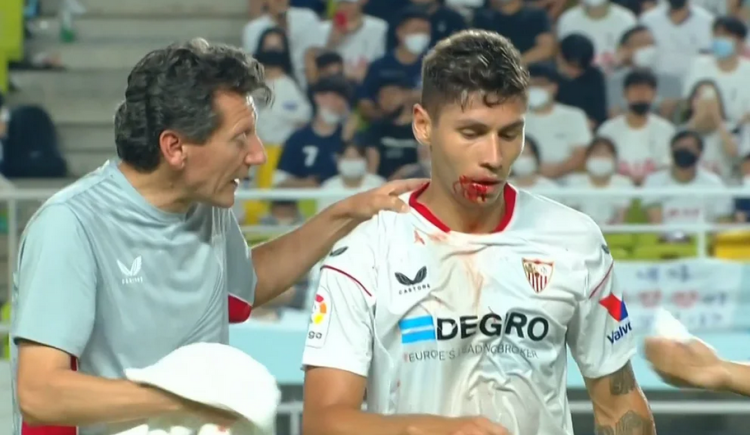 Imagen de Montiel recibió un codazo de Son y terminó ensangrentado, en el amistoso de Sevilla ante el Tottenham
